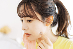 ニキビを潰すのはNG！その理由は？自分でケア・予防する方法を解説